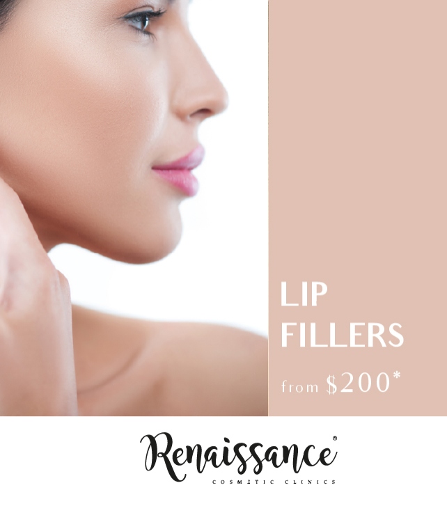 642x727_lipfillers resized